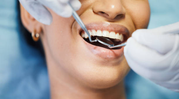 Best Emergency Dental Care for Broken or Chipped Teeth in Basalt, CO